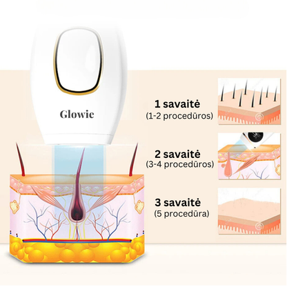 Glowie™ plaukelių šalinimo rinkinys